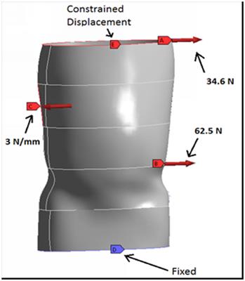 Effect of Window and Hole Pattern Cut-Outs on Design Optimization of 3D Printed Braces